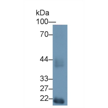 Hexosaminidase A Alpha (HEXa) Mouse Polyclonal Antibody