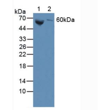 Galactosidase Beta (GLb) Human Polyclonal Antibody