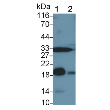 Glycoprotein IX, Platelet (GP9) Human Polyclonal Antibody