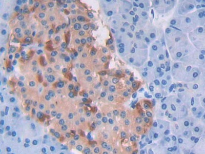 Ribonuclease P (RNASEP) Human Polyclonal Antibody