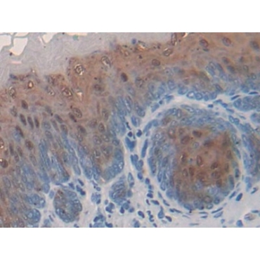 Fatty Acid Binding Protein 9, Testis (FABP9) Mouse Polyclonal Antibody