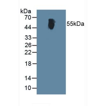 Alanine Aminotransferase (ALT) Human Polyclonal Antibody