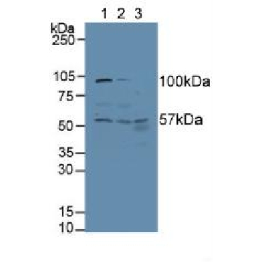 Alanine Aminotransferase (ALT) Human Polyclonal Antibody