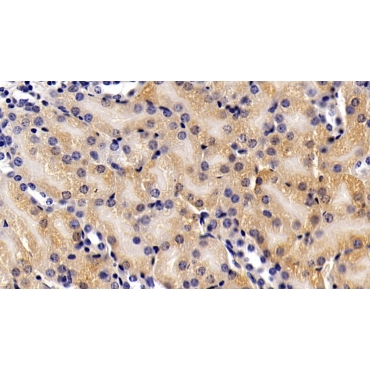 Alanine Aminotransferase (ALT) Mouse Polyclonal Antibody