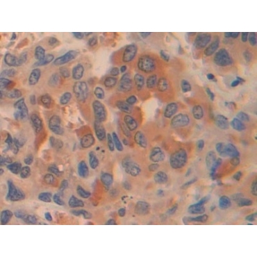 Pyruvate kinase isozymes R/L (PKLR) Human Polyclonal Antibody