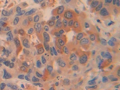 Pyruvate kinase isozymes R/L (PKLR) Human Polyclonal Antibody