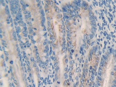 Matrix Metalloproteinase 23A (MMP23A) Rat Polyclonal Antibody