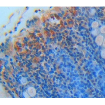 Monocyte Chemotactic Protein 4 (MCP4) Human Polyclonal Antibody
