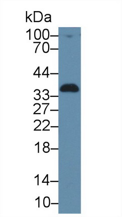 Alpha-1-Microglobulin (a1M) Human Polyclonal Antibody