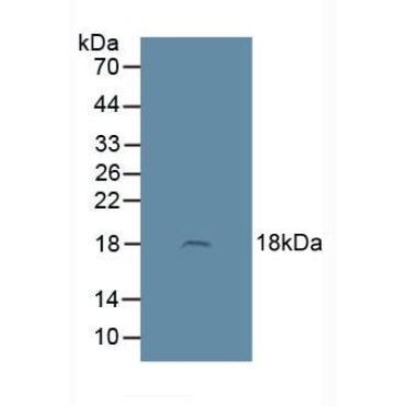 Adrenomedullin (ADM) Human Polyclonal Antibody