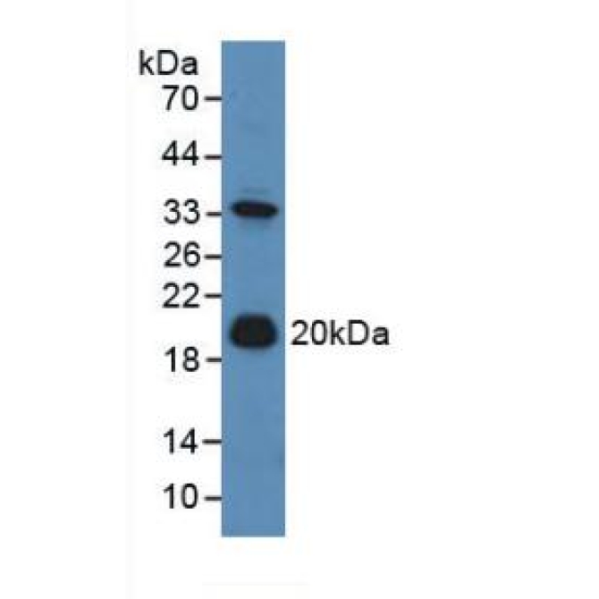 Adrenomedullin (ADM) Mouse Polyclonal Antibody