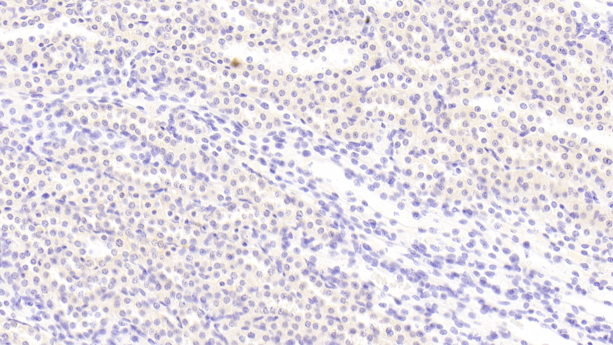Adrenomedullin (ADM) Rat Polyclonal Antibody