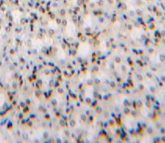 Transcription factor 20 (TCF20) Mouse Polyclonal Antibody