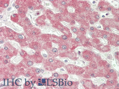 Interferon Beta (IFNb) Human Polyclonal Antibody