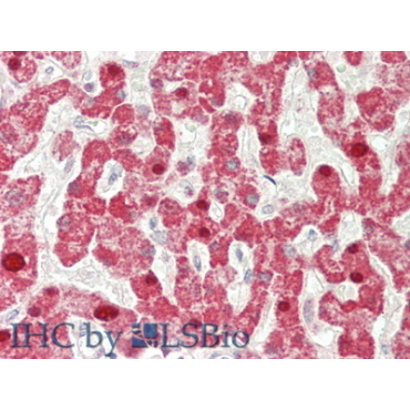 Interferon Beta (IFNb) Human Polyclonal Antibody