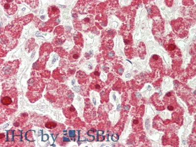 Interferon Beta (IFNb) Human Polyclonal Antibody