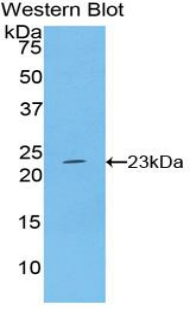 Interferon Beta (IFNb) Rabbit Polyclonal Antibody