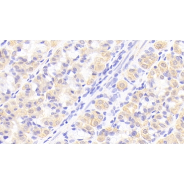 Interleukin 1 Receptor Antagonist (IL1RA) Human Polyclonal Antibody