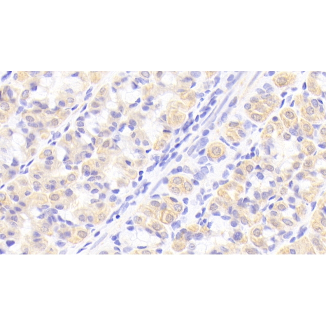 Interleukin 1 Receptor Antagonist (IL1RA) Human Polyclonal Antibody