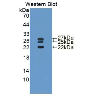 Interleukin 1 Receptor Antagonist (IL1RA) Human Polyclonal Antibody