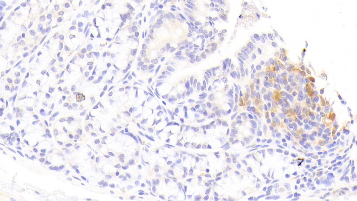 Interleukin 1 Receptor Antagonist (IL1RA) Rabbit Polyclonal Antibody