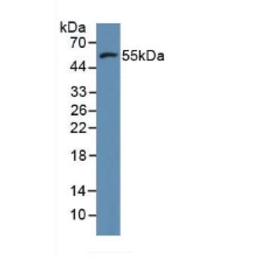 Matrix Metalloproteinase 11 (MMP11) Mouse Polyclonal Antibody