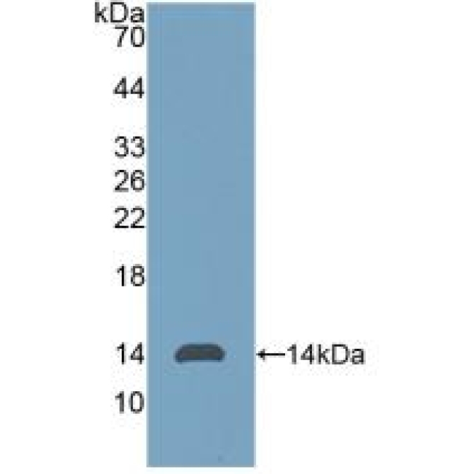 Anti-Mullerian Hormone (AMH) Human Polyclonal Antibody