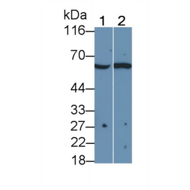 Interleukin 2 Receptor Beta (IL2Rb) Mouse Polyclonal Antibody