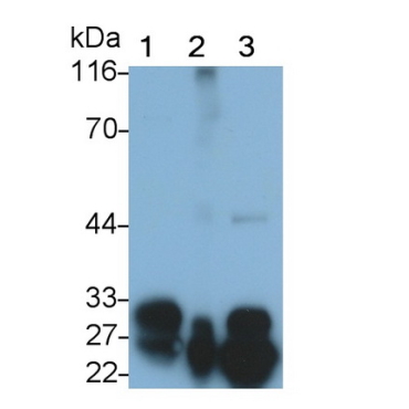 Protease, Serine 1 (PRSS1) Human Polyclonal Antibody