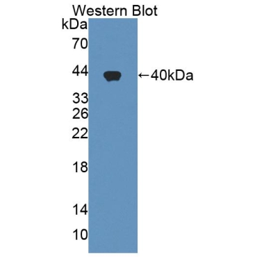 Urocortin (UCN) Human Polyclonal Antibody
