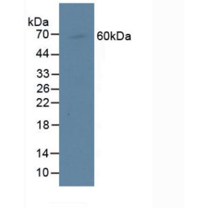 Centromere Protein I (CENPI) Human Polyclonal Antibody