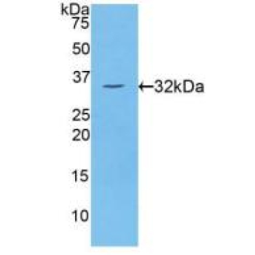 Protein Kinase C Eta (PKCh) Human Polyclonal Antibody
