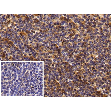 Immunoglobulin G4 (IgG4) Human Polyclonal Antibody