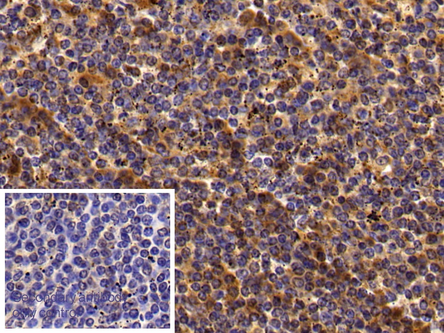 Immunoglobulin G4 (IgG4) Human Polyclonal Antibody