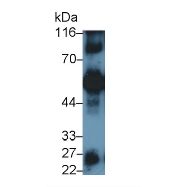 Immunoglobulin G4 (IgG4) Human Polyclonal Antibody