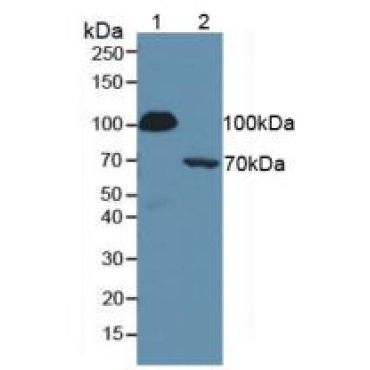 Complement 1 Inhibitor (C1INH) Human Polyclonal Antibody