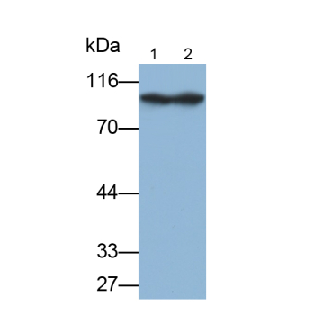 Complement 1 Inhibitor (C1INH) Human Polyclonal Antibody