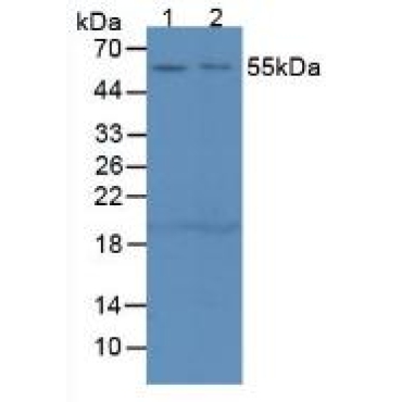 Complement 1 Inhibitor (C1INH) Mouse Polyclonal Antibody