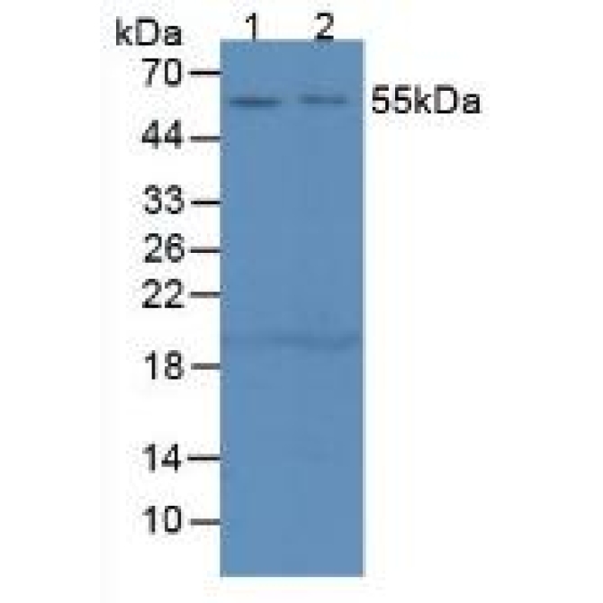 Complement 1 Inhibitor (C1INH) Mouse Polyclonal Antibody