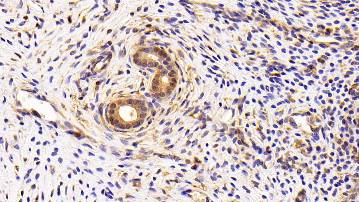 Complement 1 Inhibitor (C1INH) Rat Polyclonal Antibody
