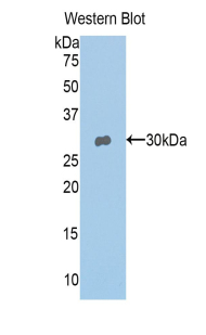 Tyrosinase (TYR) Pig Polyclonal Antibody