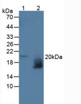 WAP Four Disulfide Core Domain Protein 2 (WFDC2) Human Polyclonal Antibody