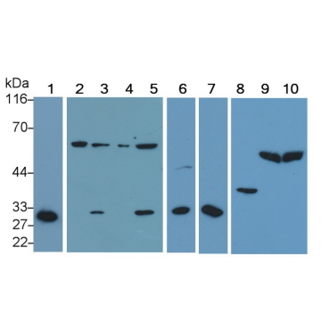 Caspase 2 (CASP2) Mouse Polyclonal Antibody