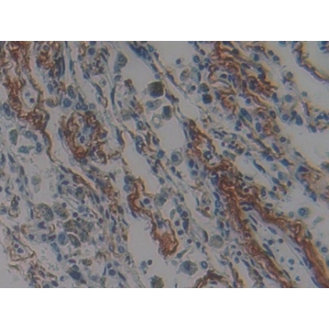 Nischarin (NISCH) Human Polyclonal Antibody