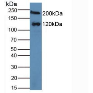Maltase-glucoamylase (MGAM) Human Polyclonal Antibody