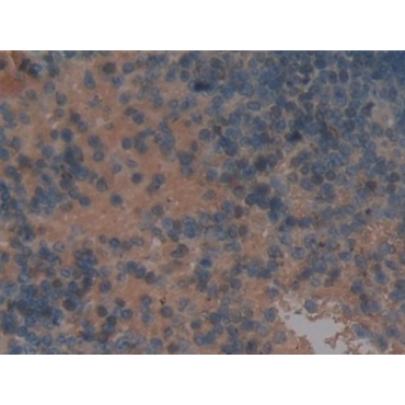 N-Acetylgalactosamine-6-Sulfatase (GALNS) Mouse Polyclonal Antibody