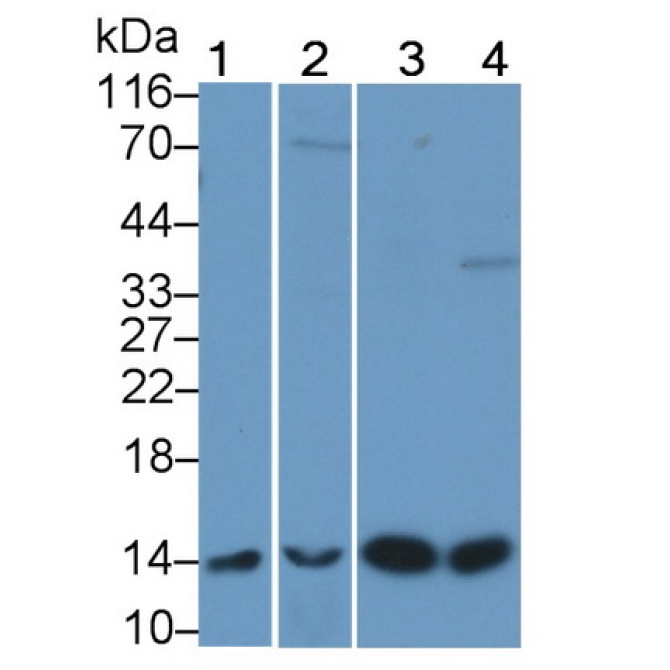 Beta-2-Microglobulin (b2M) Human Polyclonal Antibody