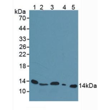Beta-2-Microglobulin (b2M) Mouse Polyclonal Antibody
