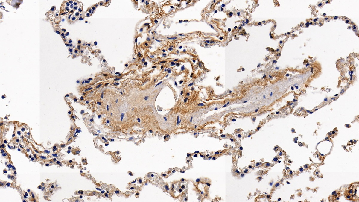 Beta-2-Microglobulin (b2M) Rhesus monkey (Simian) Polyclonal Antibody