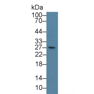 Centromere Protein H (CENPH) Human Polyclonal Antibody